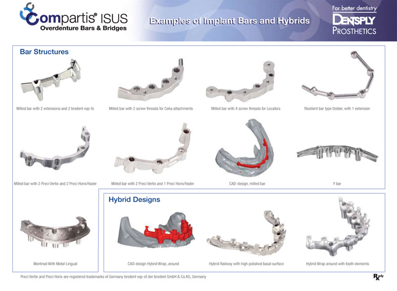Examples of Implant Bars and Hybrids